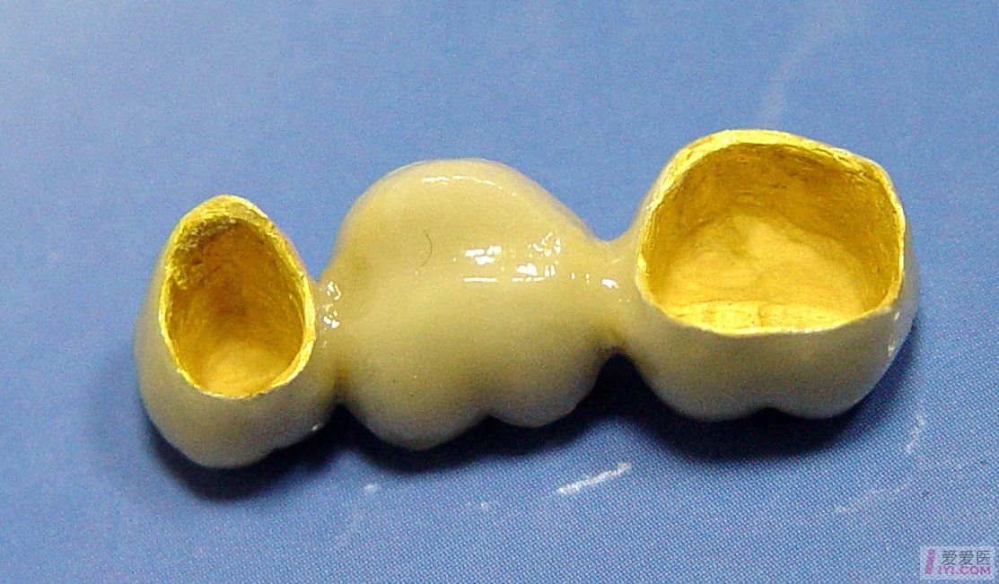 贵金属应用(贵金属应用在哪些方面)